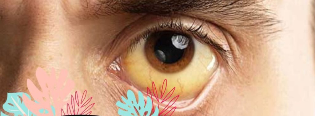 Tipos de hepatitis