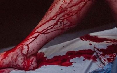 Transfusión de sangre