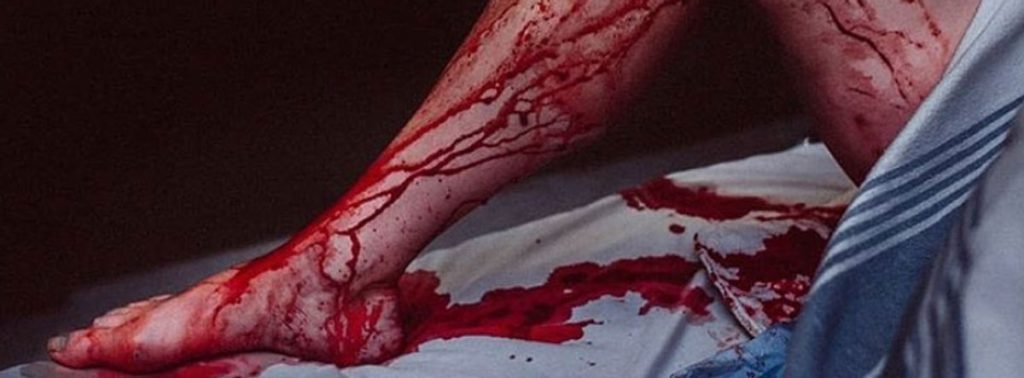 Transfusión de sangre