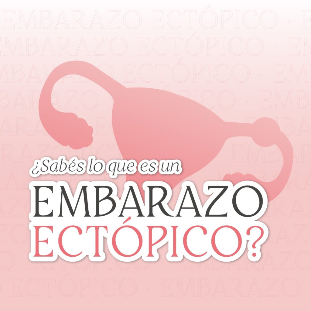 ¿Sabés lo que es un Embarazo Ectópico?