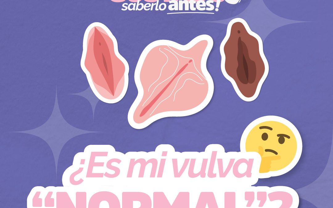 ¿Es mi vulva “normal”?